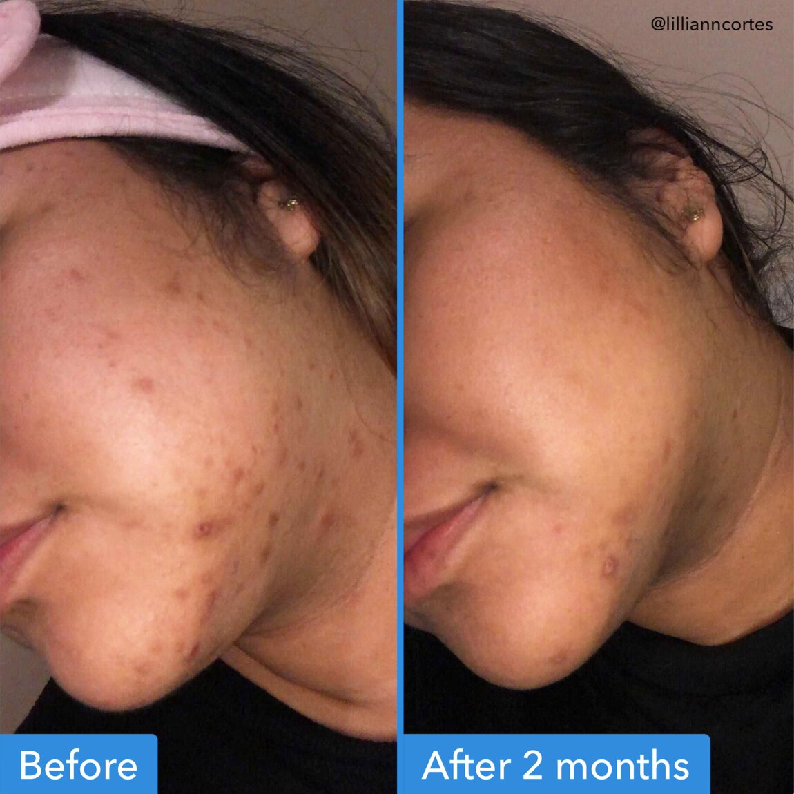 discoloration-correcting-serum-g8 zb_p.jpg