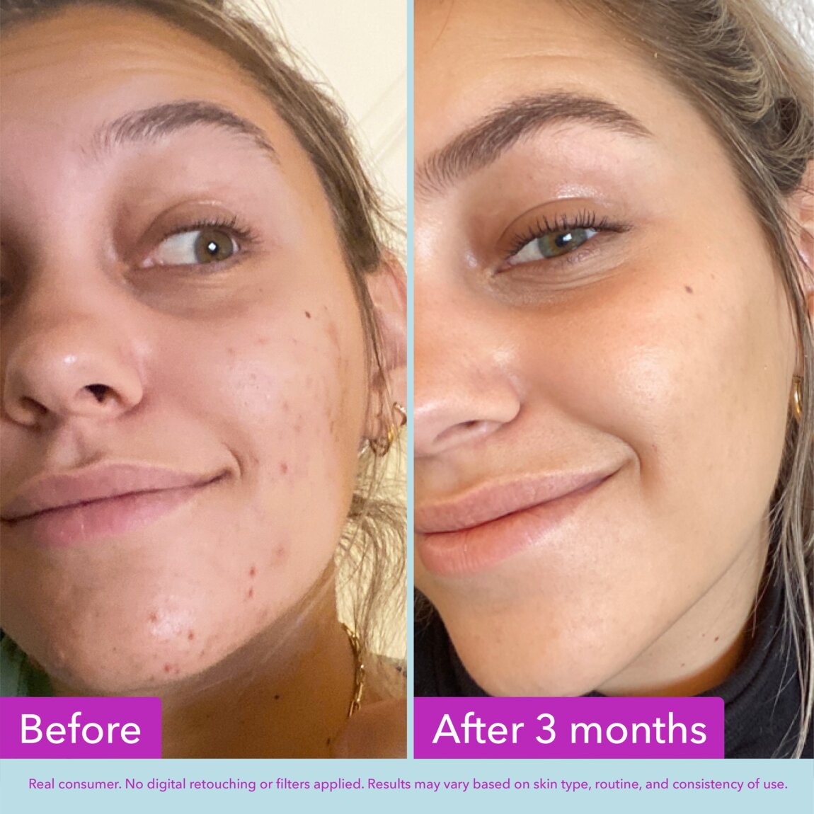niacinamide-brightening-toner-o0 zb_p.jpg